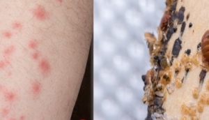 What health risks do bedbug pose?